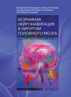 Безрамная нейронавигация в хирургии головного мозга