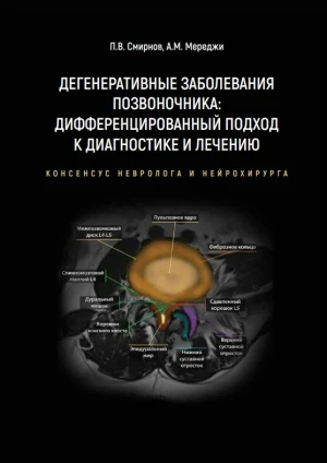 Дегенеративные заболевания позвоночника: дифференцированный подход к диагностике и лечению. Консенсус невролога и нейрохирурга